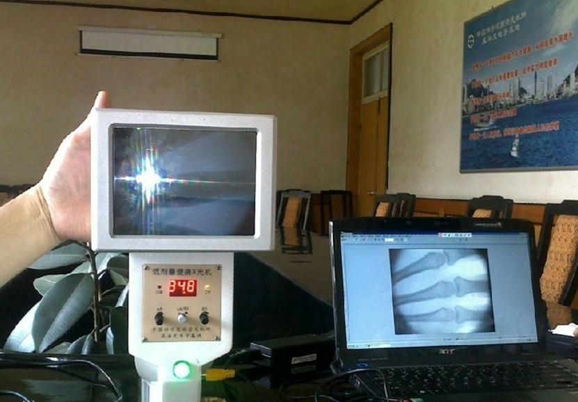 CTX-50/75便携式X光机5寸液晶型参数